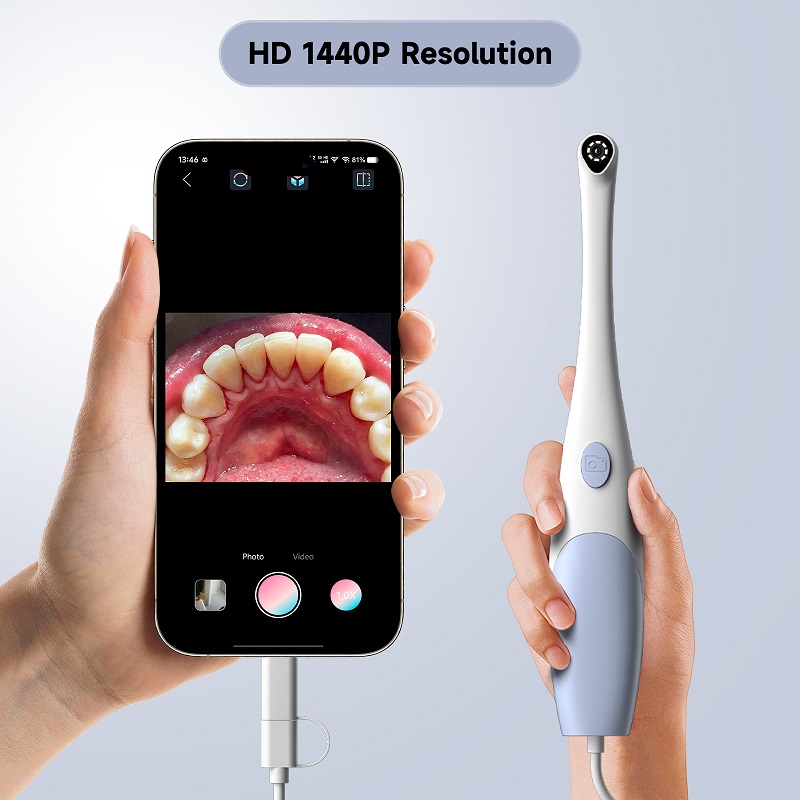 Oral Endoscope Camera 1440P Ph - Photography Lighting Professional 评论和价格