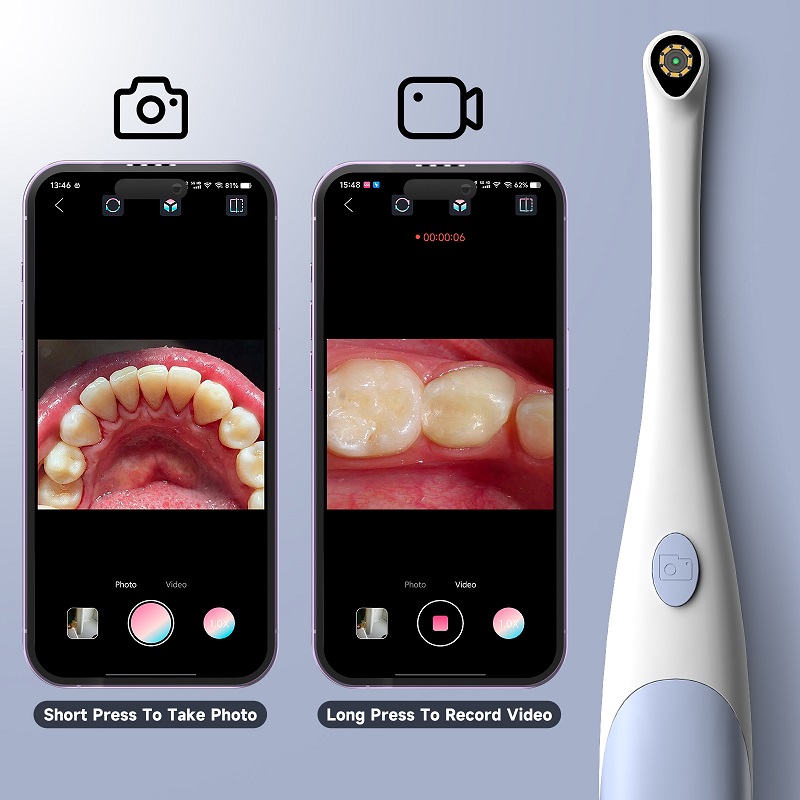 Oral Endoscope Camera 1440P Ph - Photography Lighting Professional 评论和价格
